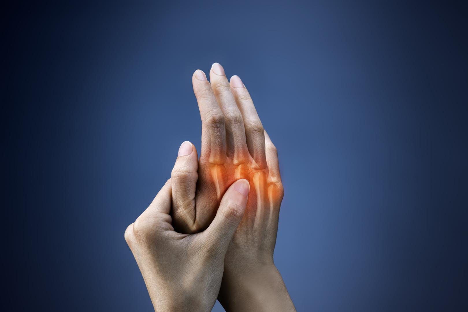 Reumatoid arthritisz